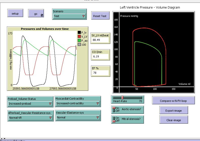 Cardiac_output-Simple_Model_01_01 preview image